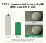 AXIS Y LHA Peel & Fill Pore Balancing Cream - Image 6